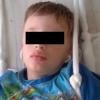 В Казани во время прогулки в садике ребенок получил перелом позвоночника