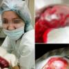 Студентку казанского медколледжа после фотосессии с органами проверят психиатры