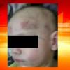 В Чистополе пьяный мужчина избил годовалого ребенка за то, что он не умеет ходить
