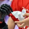 Девушке из Татарстана, потерявшей кисть на практике, протез «распечатают» на 3D-принтере в Казани