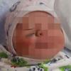 «Меньше надо дёргаться»: в Челябинской области новорождённой в роддоме порезали лицо