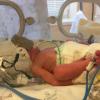 Один случай на миллион: в РКБ Татарстана спасли беременную с редчайшим заболеванием