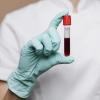 Доктор Мясников рассказал, люди с какой группой крови защищены от коронавируса